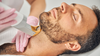 depilacion facial hombre
